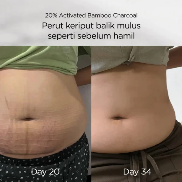 Momwell Korset Postpartum Bamboo - Gambar 5