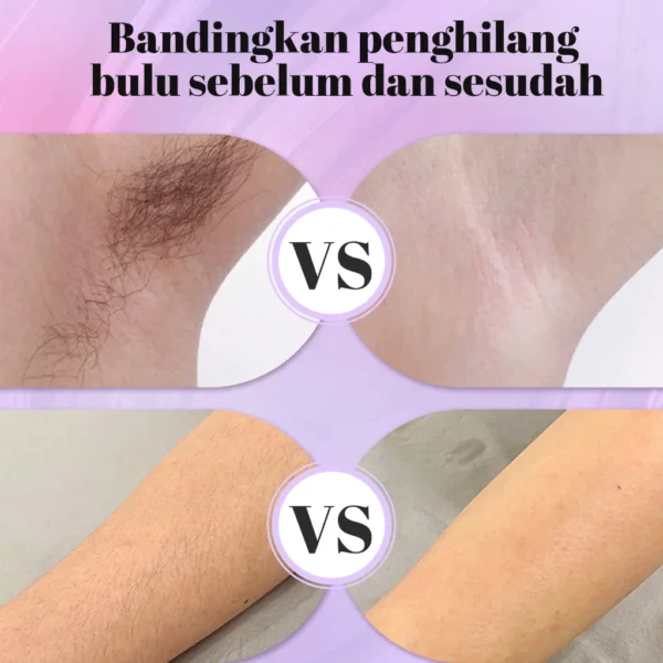 Momwell WS01 Alat Cukur Wanita - Gambar 2